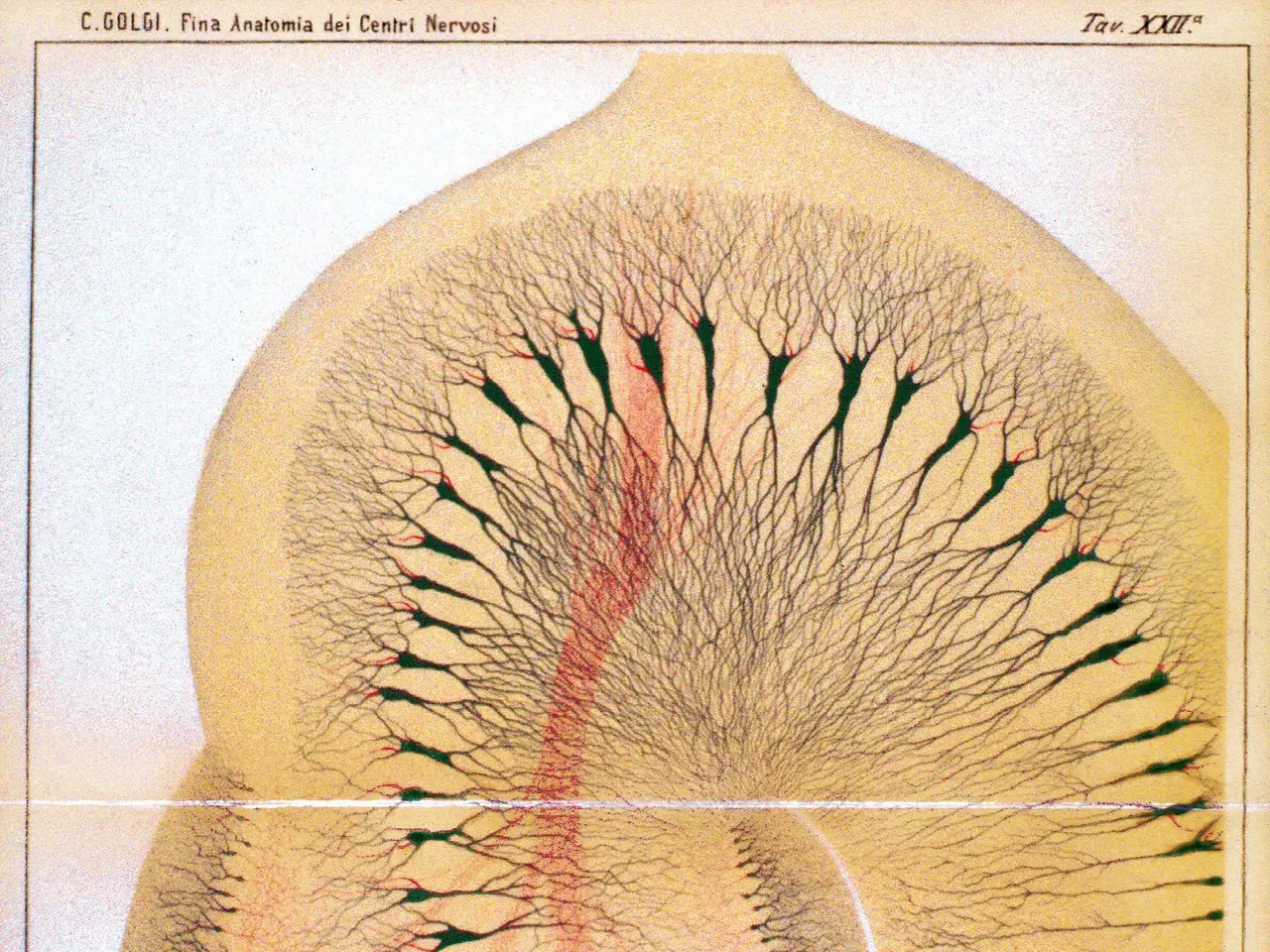 The image shows a diagram of the human eye with a red line in the middle of it, which is a photo of...