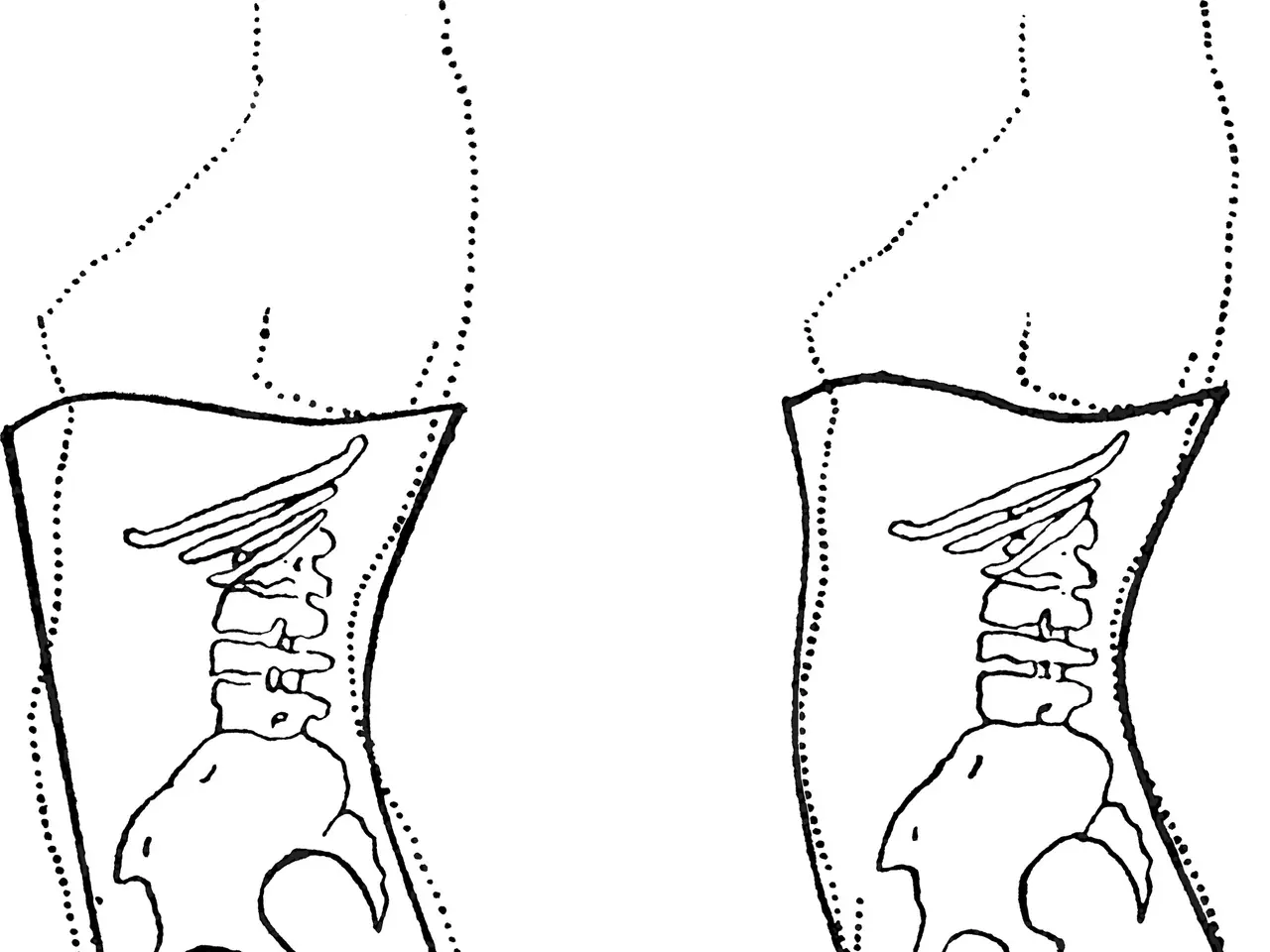 The image shows a drawing of a woman's torso with a line drawing of the cervical spine, along with...