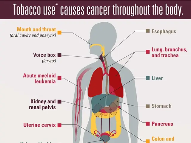 The image shows a poster with a picture of a human body and text that reads "Tobacco Use Causes...