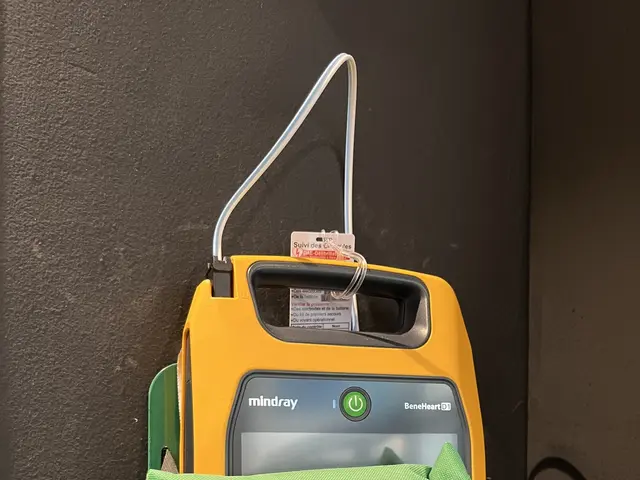 The image shows a yellow and green defibrillator sitting on top of a black table, with a green bag...