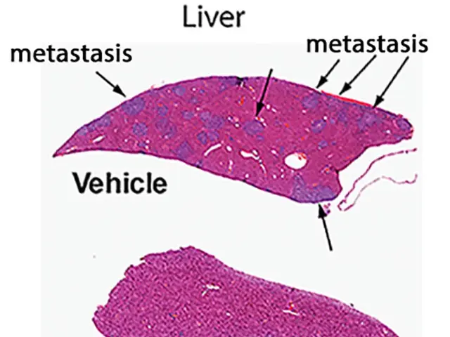 The image shows a diagram of a liver and a vehicle with the words "metastasis" and "25 mg/kg"...